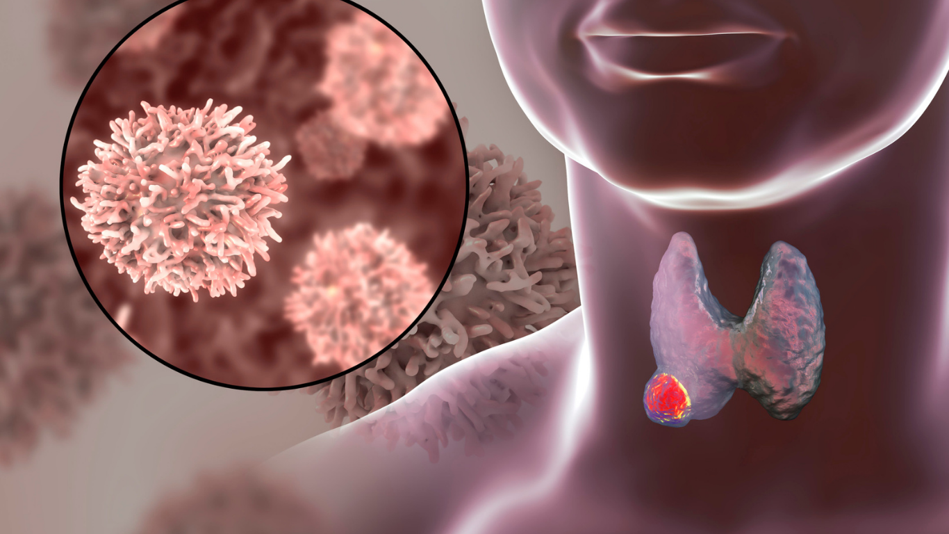 Thyroid